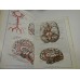 ATLAS DE ANATOMIE UMANA - Mircea Ifrim  - volumul 3